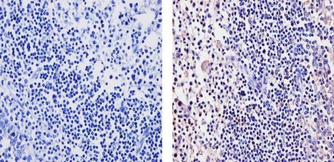 BAFF Antibody in Immunohistochemistry (Paraffin) (IHC (P))