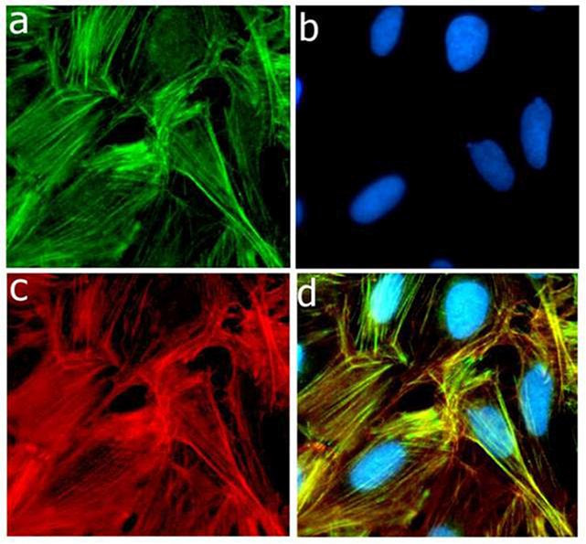 P-Selectin Antibody in Immunocytochemistry (ICC/IF)