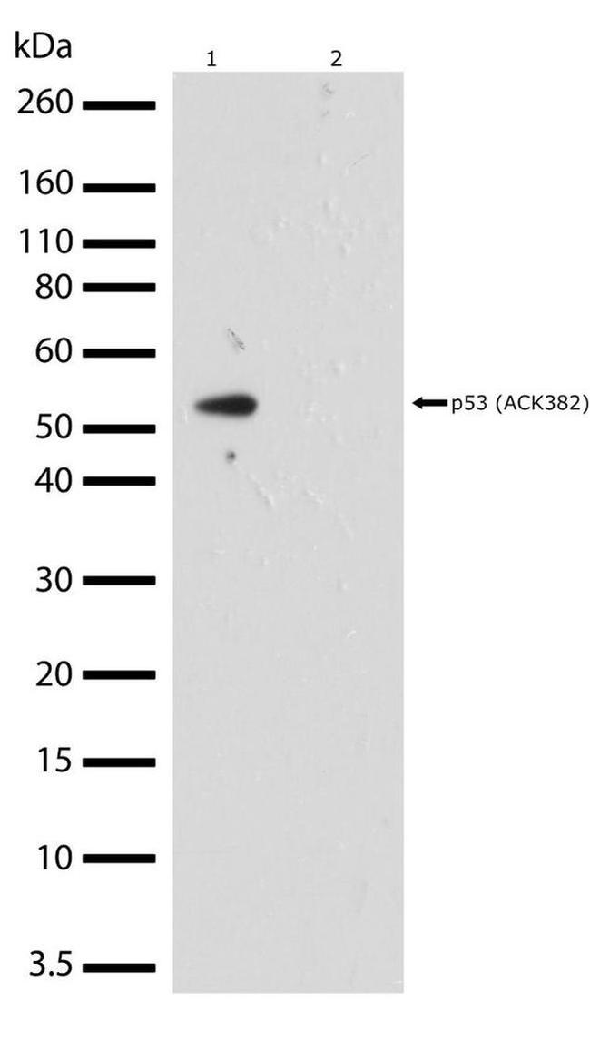 Acetyl-p53 (Lys382) Antibody