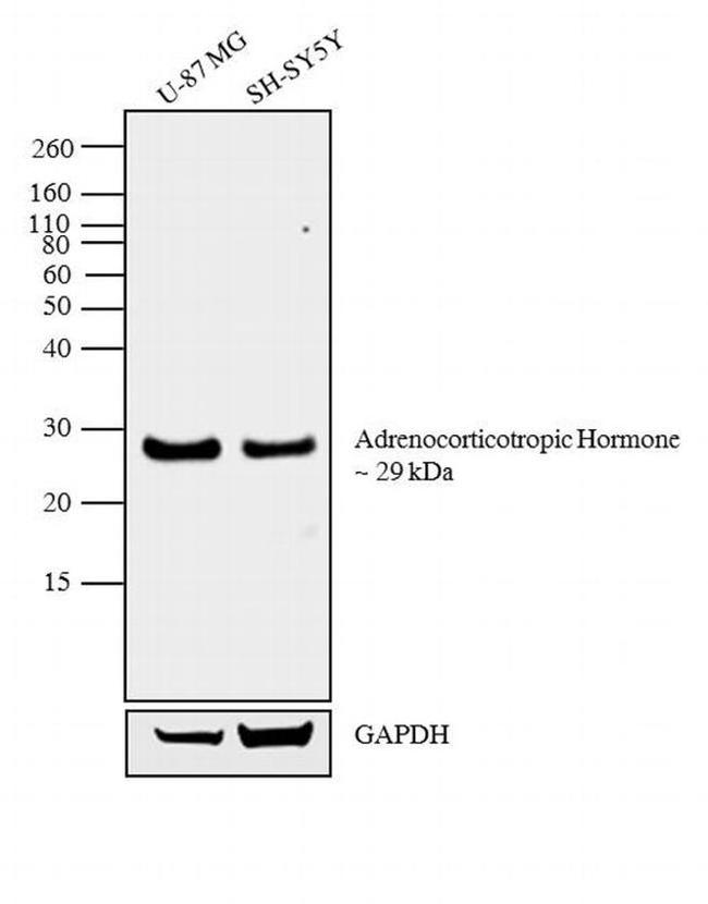 ACTH Antibody in Western Blot (WB)