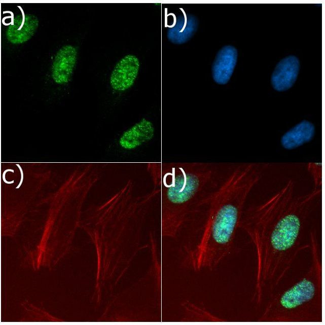 NFkB p50 Antibody in Immunocytochemistry (ICC/IF)