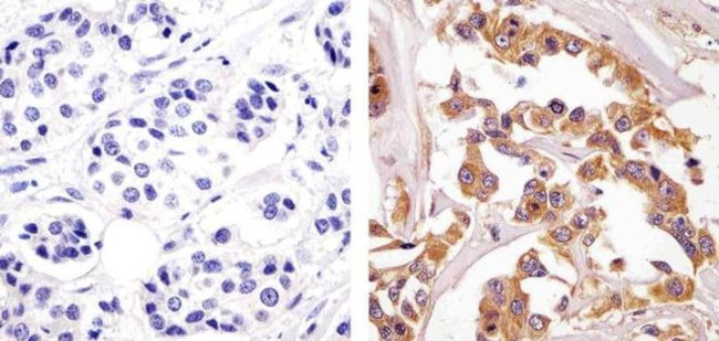 ErbB2 (HER-2) Antibody in Immunohistochemistry (Paraffin) (IHC (P))