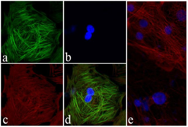 Troponin I Antibody in Immunocytochemistry (ICC/IF)