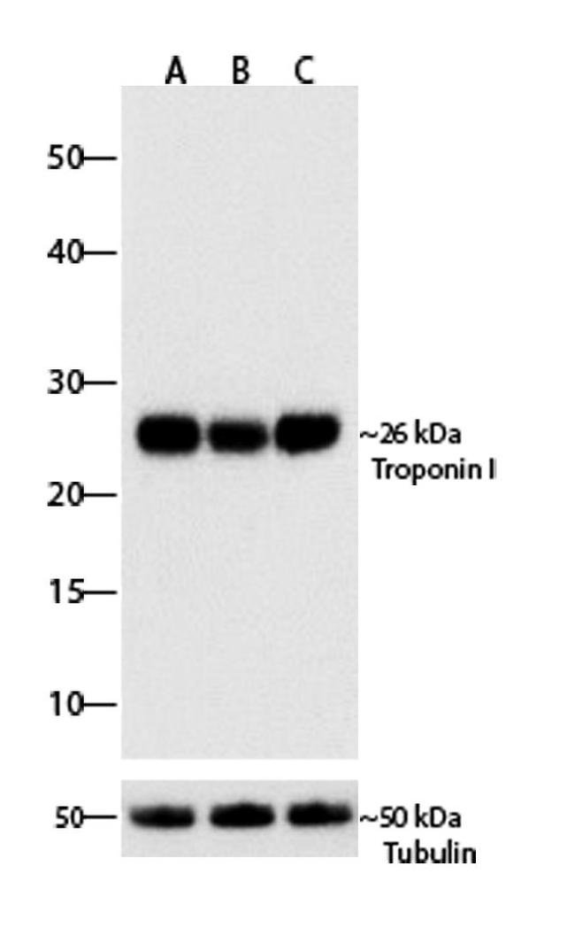 Troponin I Antibody in Western Blot (WB)