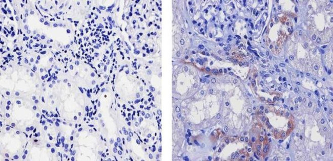 FZD4 Antibody in Immunohistochemistry (Paraffin) (IHC (P))