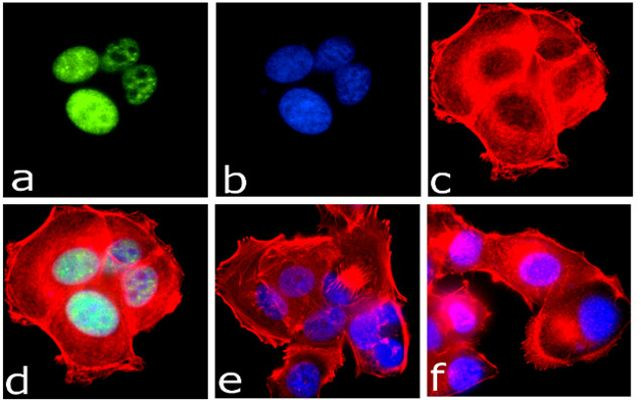 Phospho-IRS1 (Ser312) Antibody in Immunocytochemistry (ICC/IF)