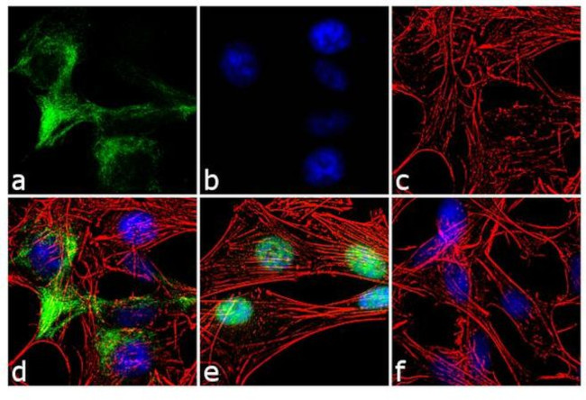 NF-H Antibody in Immunocytochemistry (ICC/IF)