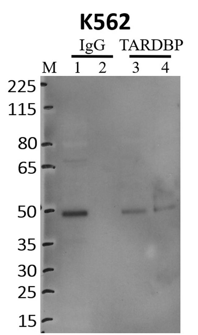 TDP-43 Recombinant Polyclonal Antibody (1HCLC) (711051)