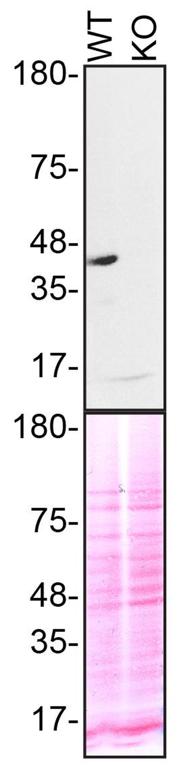 TDP-43 Recombinant Polyclonal Antibody (1HCLC) (711051)