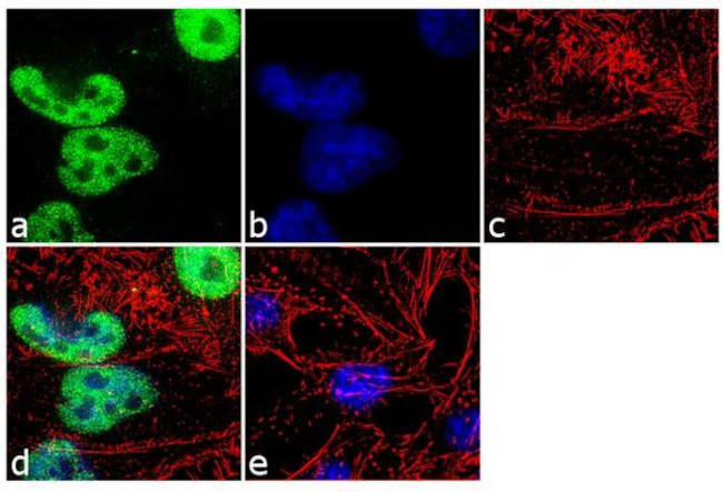 TDP-43 Recombinant Polyclonal Antibody (1HCLC) (711051)