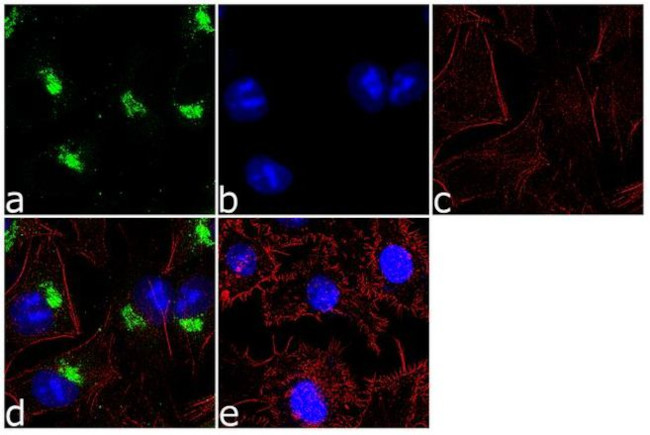 alpha-1 Antitrypsin Antibody in Immunocytochemistry (ICC/IF)