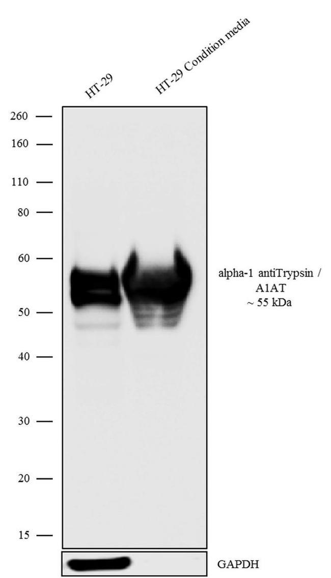 alpha-1 Antitrypsin Antibody in Western Blot (WB)