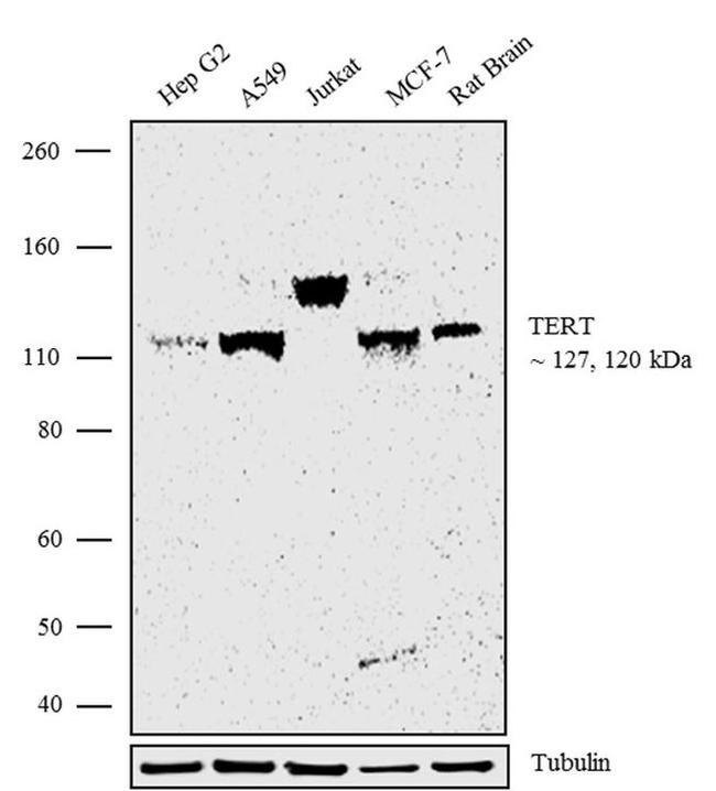 TERT Antibody in Western Blot (WB)