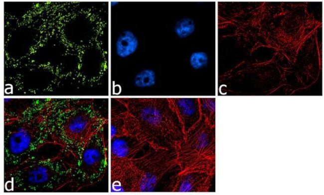 Desmoplakin Antibody in Immunocytochemistry (ICC/IF)