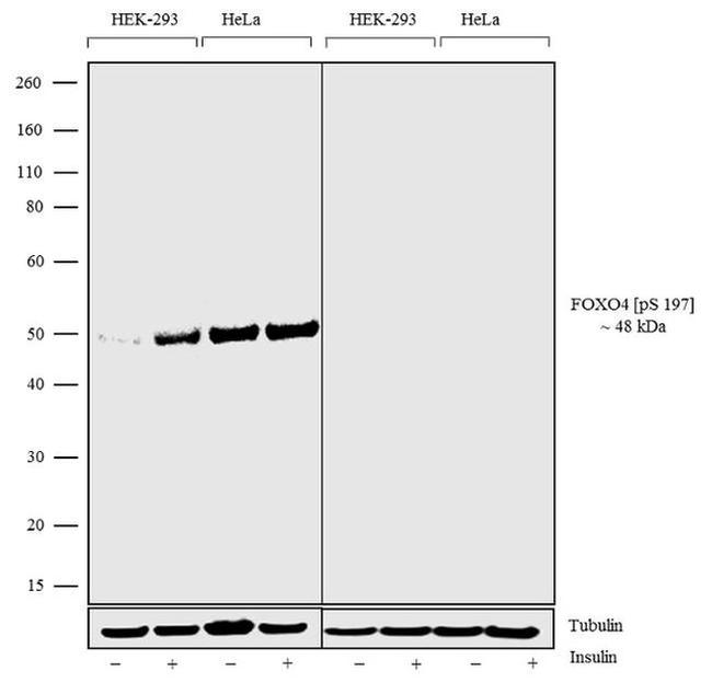 Phospho-FOXO4 (Ser197) Antibody in Western Blot (WB)