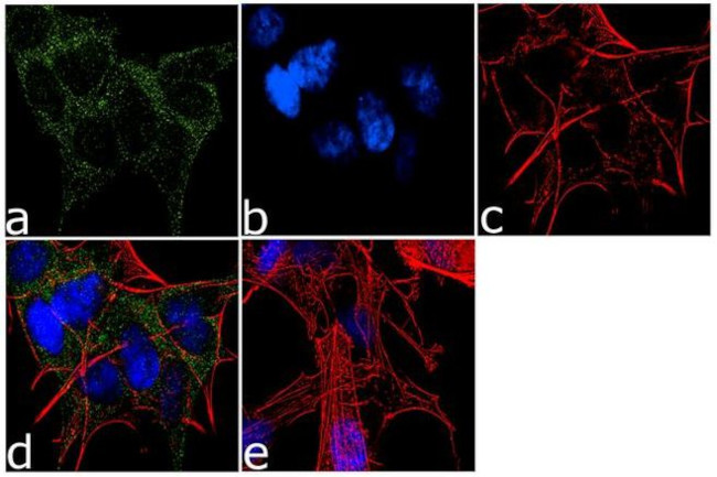 TBK1 Antibody in Immunocytochemistry (ICC/IF)