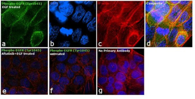 Phospho-EGFR (Tyr1045) Antibody in Immunocytochemistry (ICC/IF)