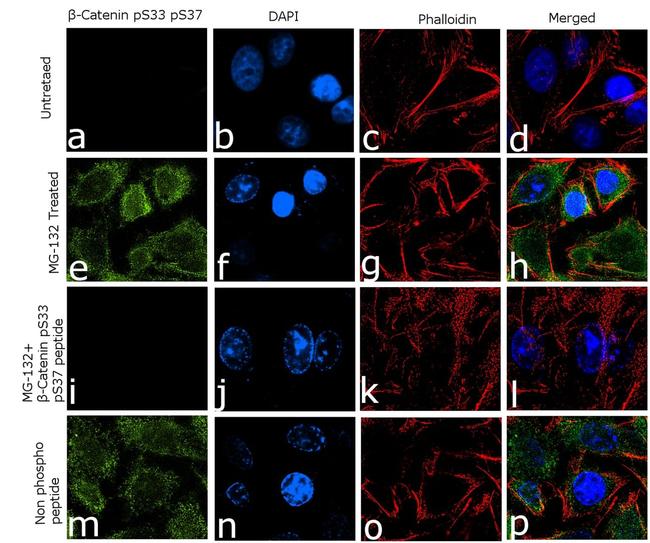 Phospho-beta Catenin (Ser33, Ser37) Antibody