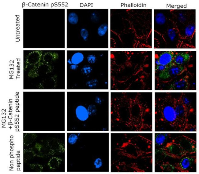 Phospho-beta Catenin (Ser552) Antibody in Immunocytochemistry (ICC/IF)