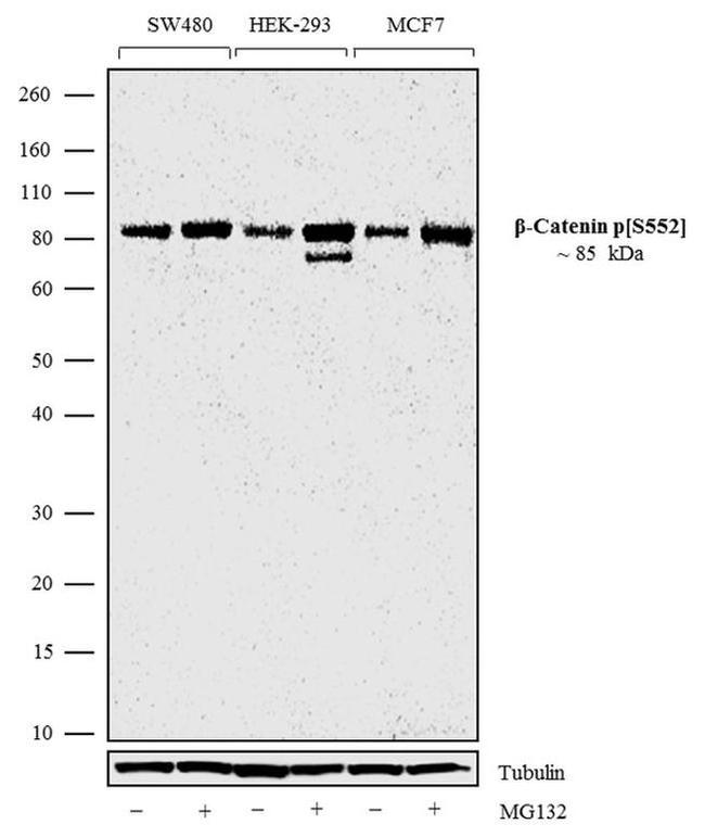 Phospho-beta Catenin (Ser552) Antibody in Western Blot (WB)