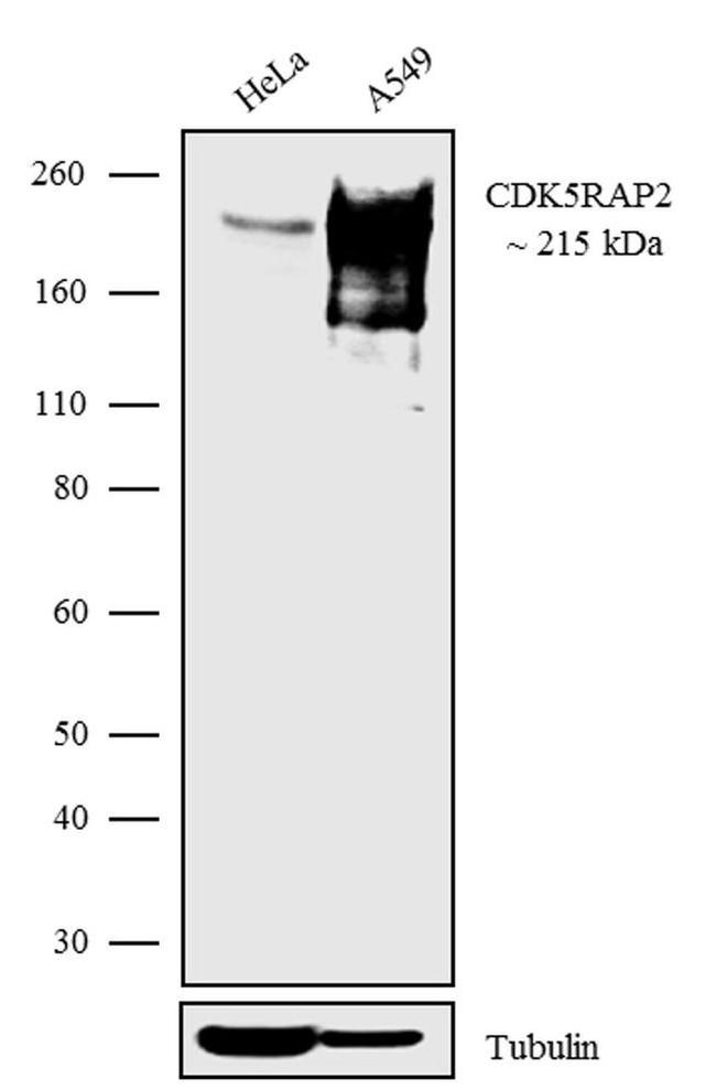 CDK5RAP2 Antibody in Western Blot (WB)