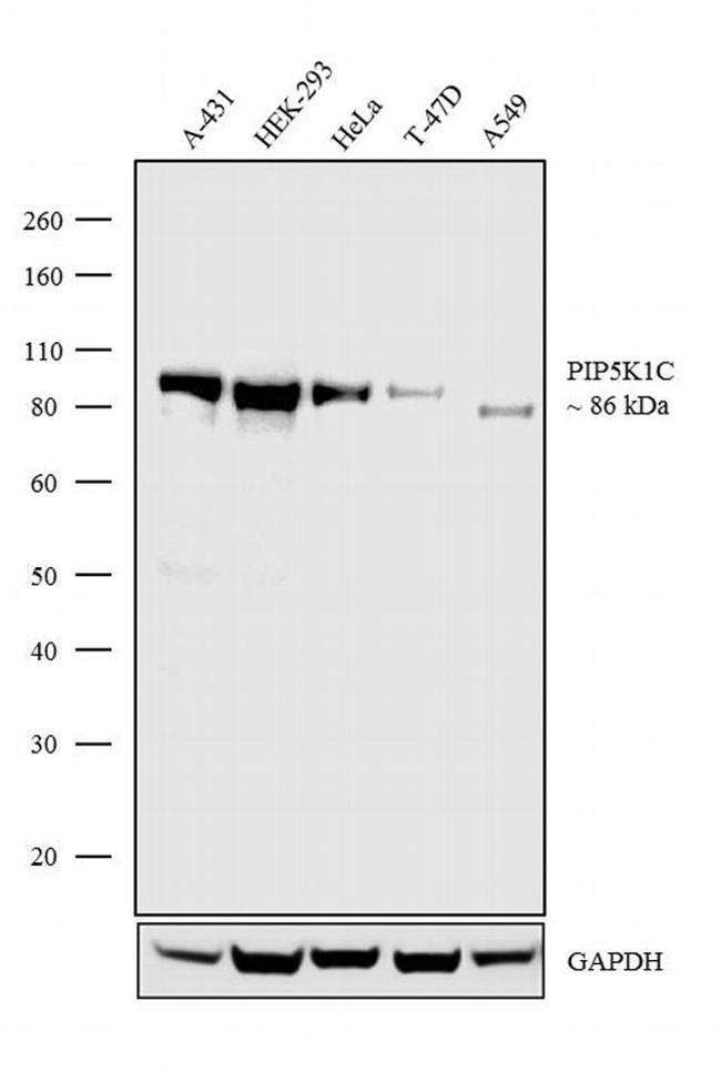 PIP5K1C Antibody in Western Blot (WB)