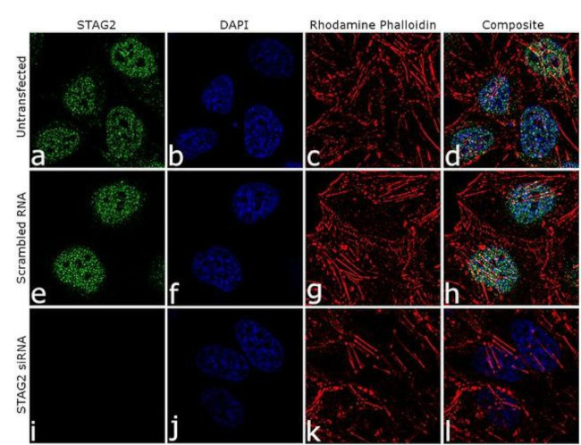 STAG2 Antibody