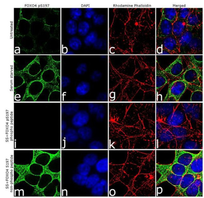 Phospho-FOXO4 (Ser197) Antibody in Immunocytochemistry (ICC/IF)