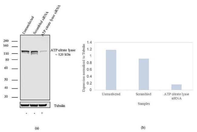 ATP Citrate lyase Antibody in Western Blot (WB)