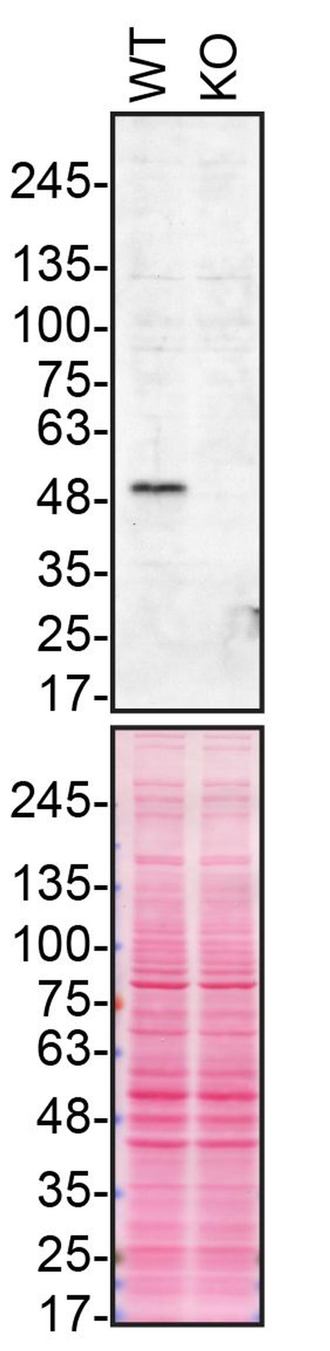 Parkin Recombinant Polyclonal Antibody (21HCLC)