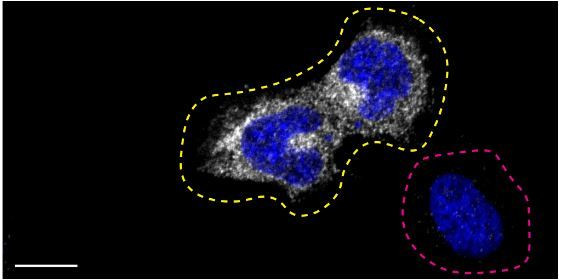 Optineurin Antibody