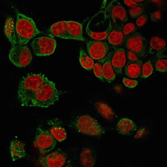 TNF-alpha (Tumor Necrosis Factor alpha) Antibody in Immunocytochemistry (ICC/IF)