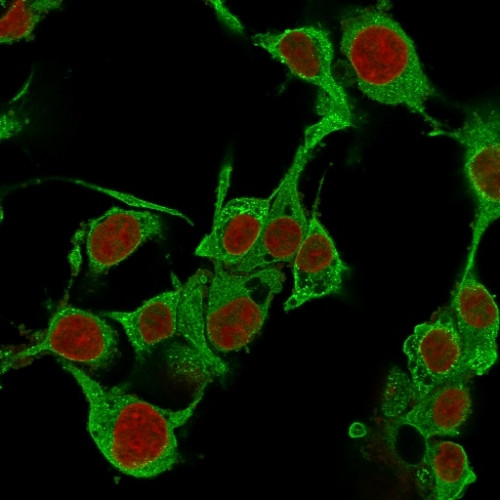 TNF-alpha (Tumor Necrosis Factor alpha) Monoclonal Antibody (TNFA, 1172)