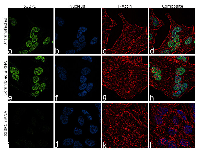 53BP1 Antibody in Immunocytochemistry (ICC/IF)