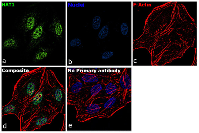 HAT1 Antibody in Immunocytochemistry (ICC/IF)