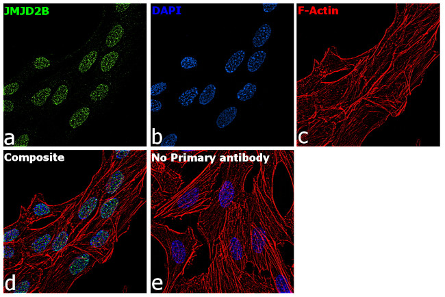 JMJD2B Antibody in Immunocytochemistry (ICC/IF)