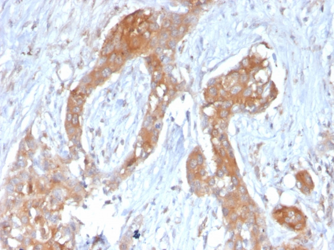 A20/TNFAIP3 Antibody in Immunohistochemistry (Paraffin) (IHC (P))