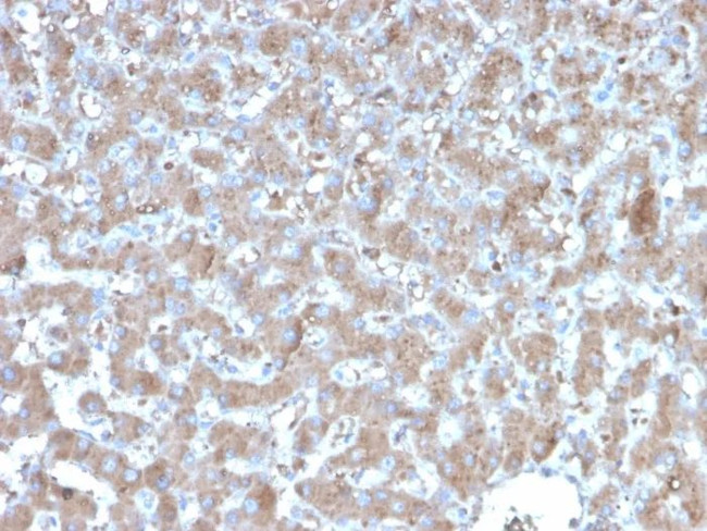 A20/TNFAIP3 Antibody in Immunohistochemistry (Paraffin) (IHC (P))