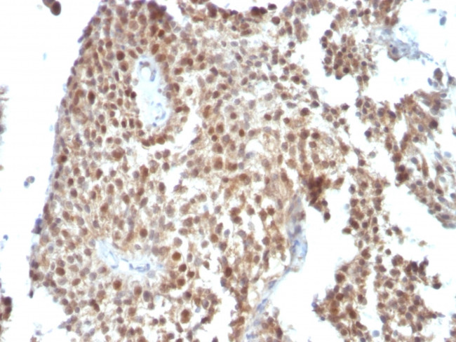 p53 Tumor Suppressor Protein Antibody in Immunohistochemistry (Paraffin) (IHC (P))