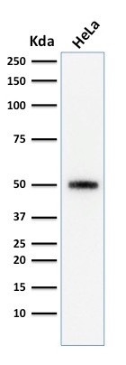 p53 Tumor Suppressor Protein Antibody in Western Blot (WB)