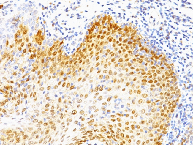 p53 Tumor Suppressor Protein Antibody in Immunohistochemistry (Paraffin) (IHC (P))