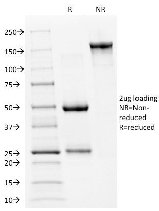 p53 Tumor Suppressor Protein Antibody in SDS-PAGE (SDS-PAGE)