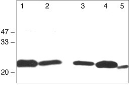 Claudin 1 Polyclonal Antibody (MH25) (71-7800)