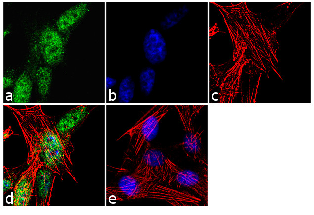 FOXP2 Antibody in Immunocytochemistry (ICC/IF)