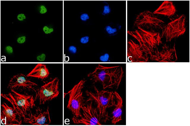 H3K79me2 Antibody in Immunocytochemistry (ICC/IF)