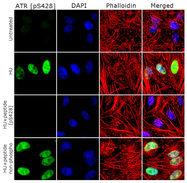 Phospho-ATR (Ser428) Antibody in Immunocytochemistry (ICC/IF)