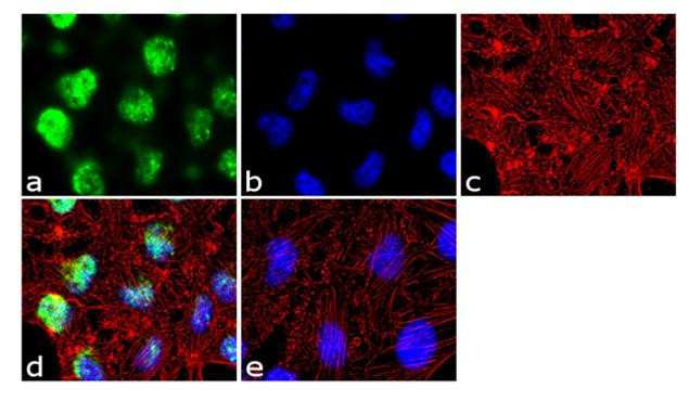 PRMT2 Antibody in Immunocytochemistry (ICC/IF)