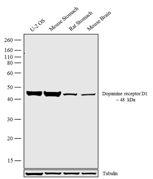 DRD1 Antibody in Western Blot (WB)