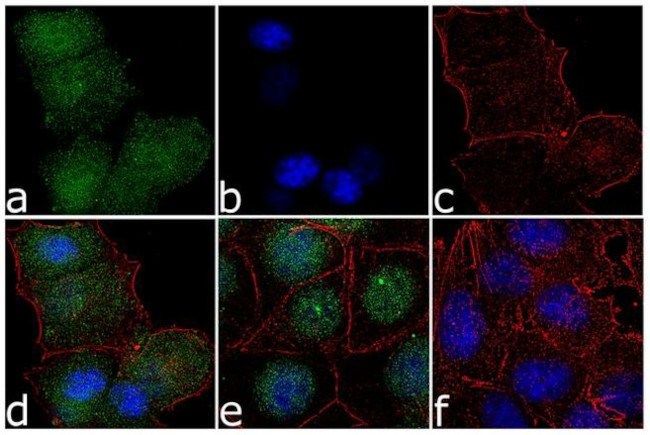 ERK5 Antibody in Immunocytochemistry (ICC/IF)