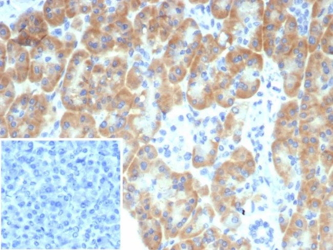 TRPC6/Transient Receptor Potential Cation Channel Subfamily C Member 6 Antibody in Immunohistochemistry (Paraffin) (IHC (P))